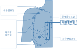 ▲ 내유림프절 위치 이미지. (사진=국립암센터 제공)