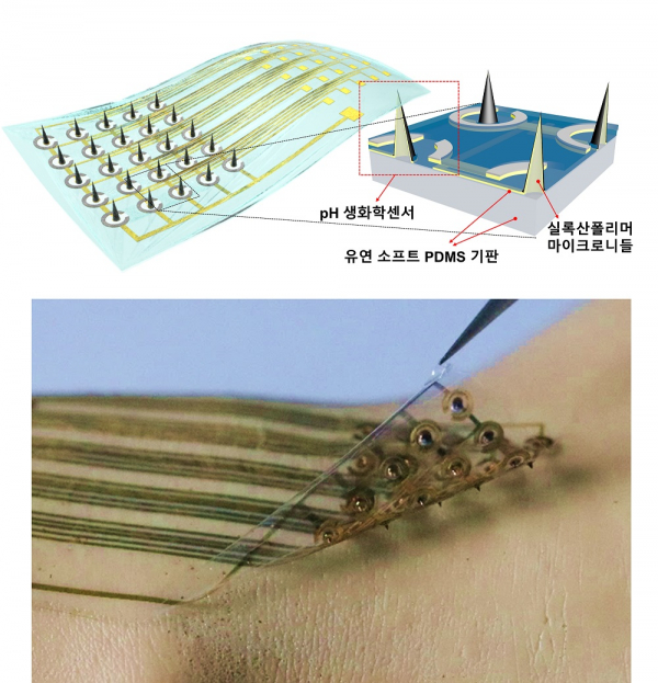 연구에서 개발한 플렉서블 마이크로니들 생화학센서의 개요도 및 실제 사진 (사진=KAIST 제공)
