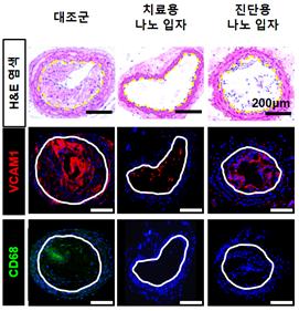 이상 혈류 타게팅 펩타이드를 부착한 치료용 나노 입자, 진단용 나노 입자를 투여한 경우, 혈관 협착률이 줄어들고 혈관 내피 세포 기능 이상이 줄었다.(사진=연세대 의과대학)
