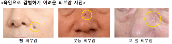 사진=고려대학교 안암병원