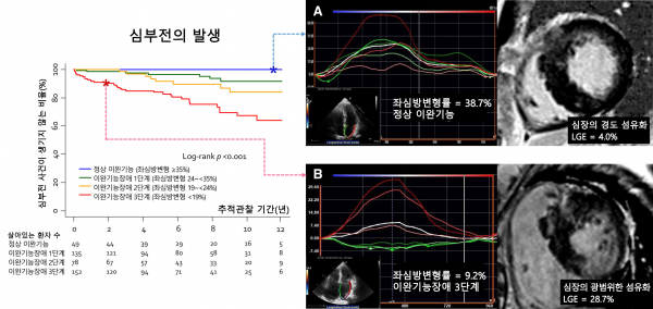 심부전 관련 생존율과 환자 사례 사진.(사진=서울대병원)