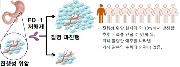 진행성 위암 환자에서 면역관문억제제(PD-1 저해제) 투여에 따른 결과.(사진=세브란스)