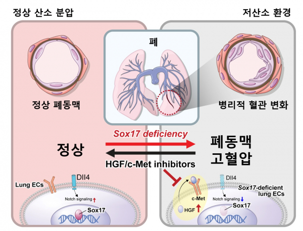 Sox17 유전자가 결핍되고 저산소 환경에 노출되면 폐동맥 고혈압의 발생 위험이 높다.(이미지=서울대병원)