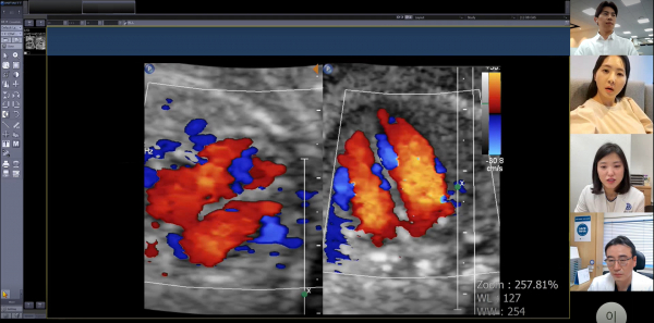 보호자와 산모, 2차 의료기관(미즈메디병원 전진동 진료부장), 세브란스병원(권하얀 산부인과 교수) 주치의가 산모의 초음파 검사 결과를 함께 보며 협진을 하는 모습.(사진=세브란스병원)