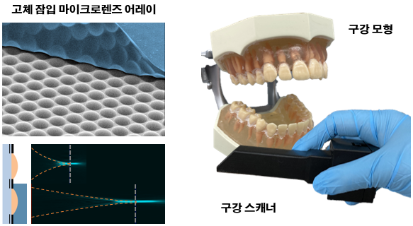 고체 잠입 마이크로렌즈 어레이 및 구강 스캐너와 구강 모형 사진.(사진=KAIST)