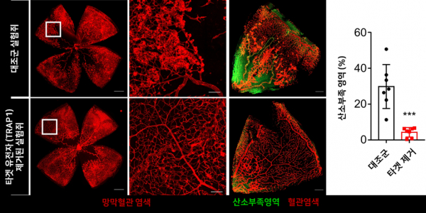 'TRAP1(트랩원) 유전자' 제거 시 망막병증 개선 효과 검증.(사진=UNIST)
