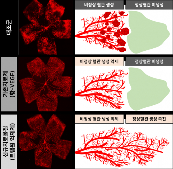 개발된 물질의 망막병증 치료 활성 비교.(사진=UNIST)